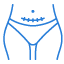 C-Section Surgery