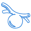 Stent Procedure Surgery