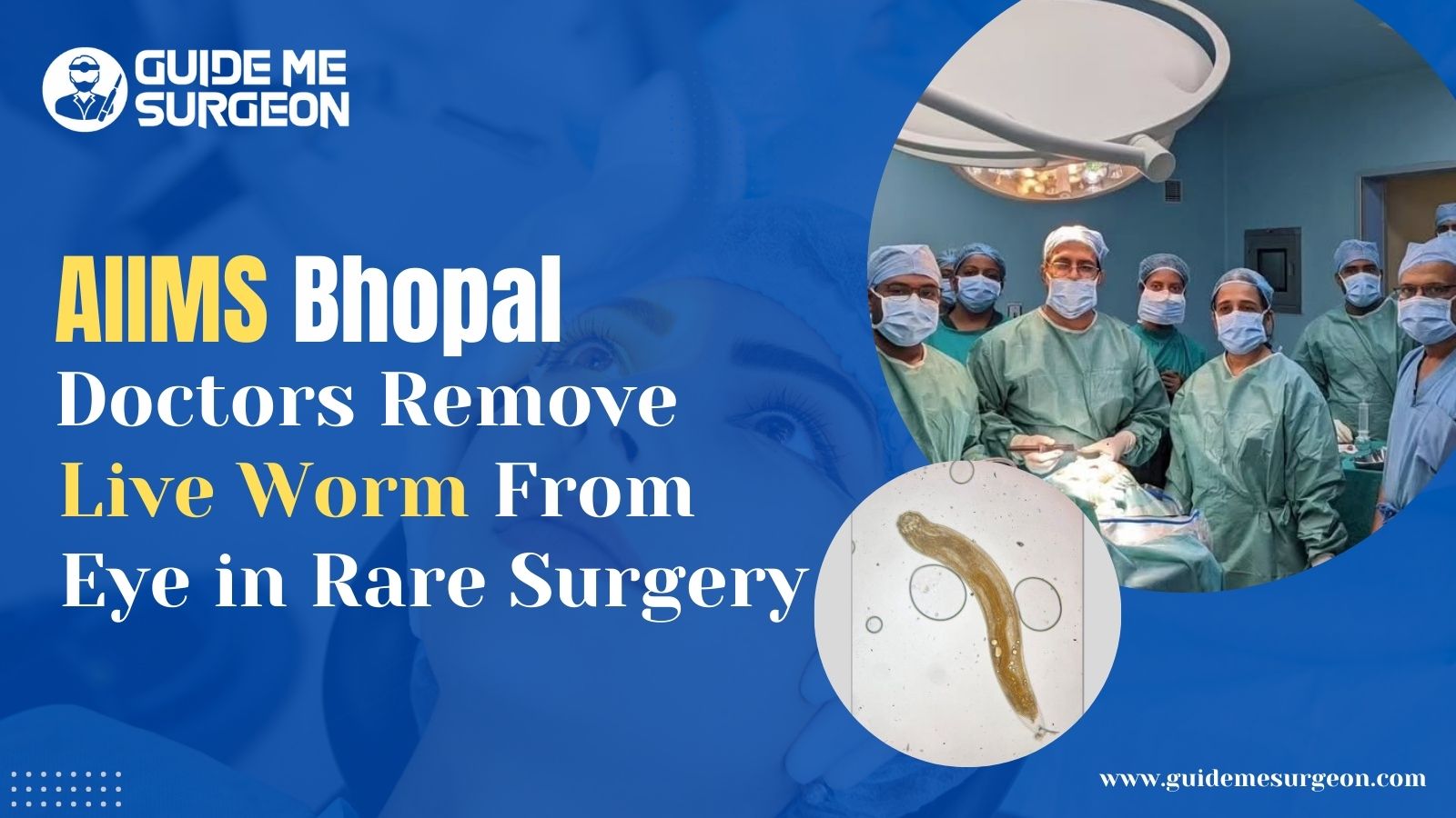 Doctors in Bhopal Remove Live Worm from Patient’s Eye in a Rare Surgery
